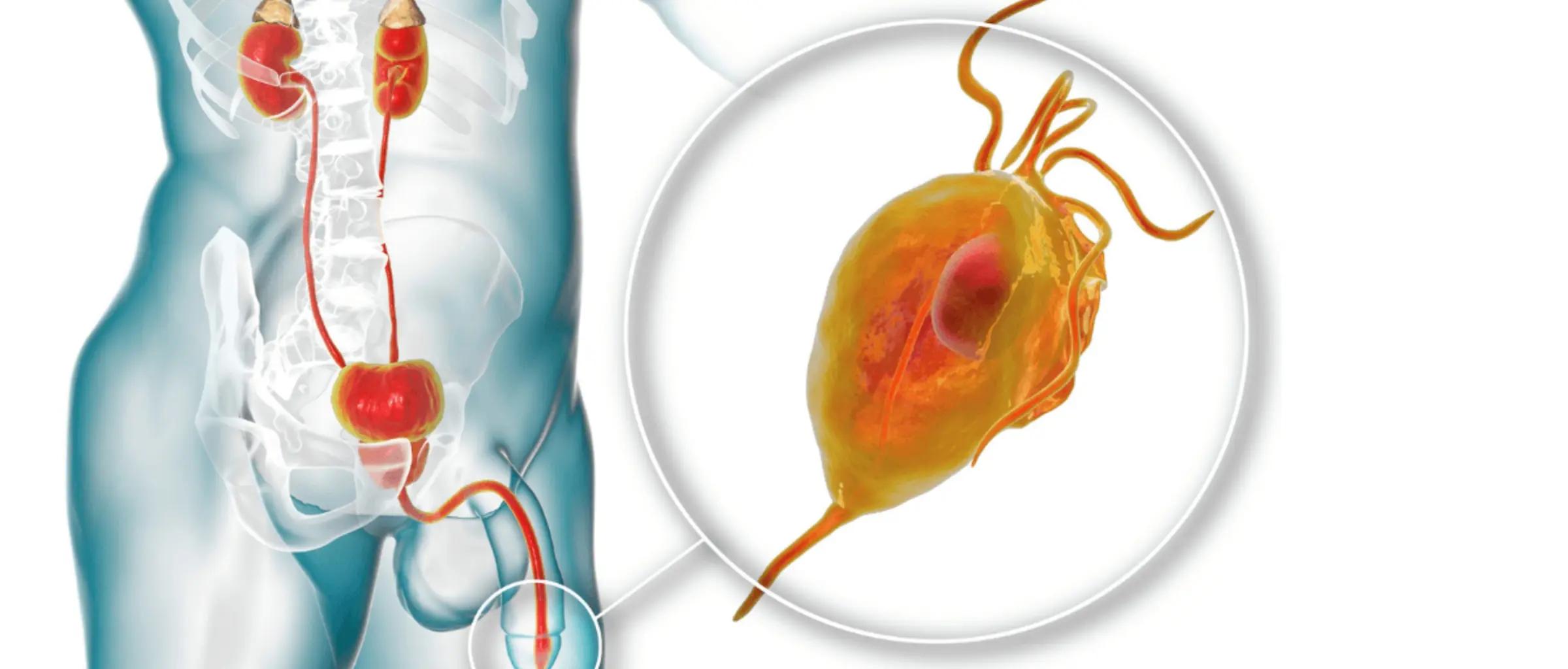 TransmissionUrethritis