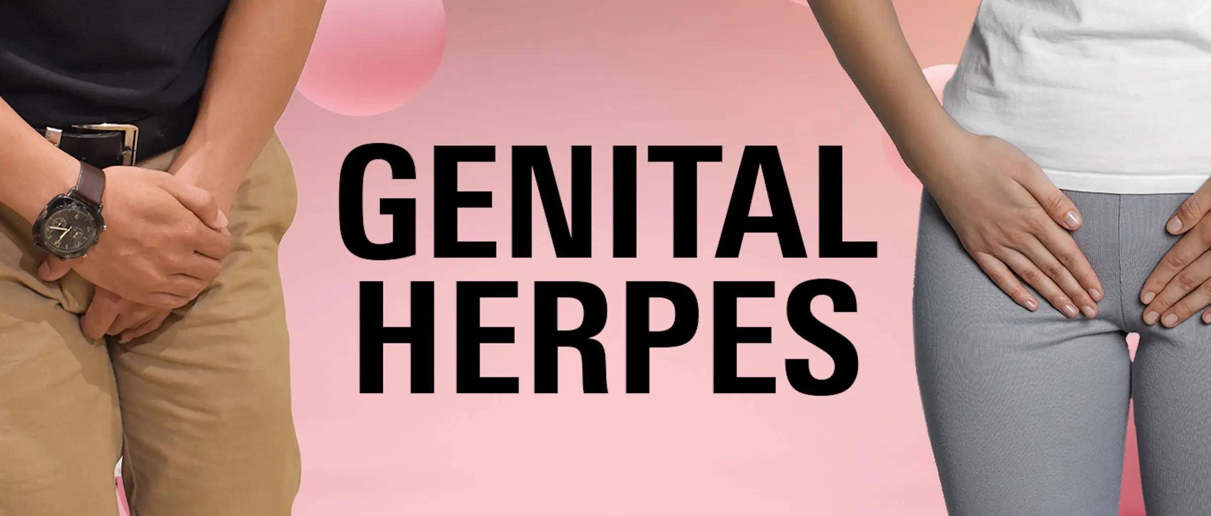 WhatGenitalHerpes